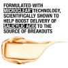 imageNeutrogena SkinClearing Mineral AcneConcealing Pressed Powder Compact ShineFree ampamp OilAbsorbing Makeup with Salicylic Acid to Cover Treat ampamp Prevent Breakouts Soft Beige 5038 oz010 Classic Ivory