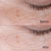 imageNEUTROGENA Collagen Bank Reviving Eye Cream Under Eye Cream Helps Preserve Collagen Visibly Improves Dark Circles Puffiness Fine Lines Texture Fragrance Free with Peptides 05 oz