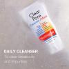 imageNeutrogena Clear Pore 2 in 1 Facial CleanserFace Mask with Kaolin ampamp Bentonite Clay ampamp 35 Benzoyl Peroxide Acne Treatment Medication Daily Face Wash ampamp Shine Control Clay Mask 42 fl Oz Pack of 6