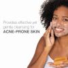 imageNeutrogena Facial Cleansing Bar for AcneProne Skin Gentle NonMedicated Daily Cleanser NonComedogenic Transparent Soap with Glycerin No Dyes or Detergents 35 oz35 Ounce Pack of 3