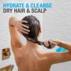 imageNeutrogena Moisturizing Healthy Scalp Hydro Boost Conditioner for Dry Hair and Scalp with Hydrating Hyaluronic Acid pHBalanced Paraben ampamp PhthalateFree ColorSafe 12 fl oz12 Fl Oz Pack of 3