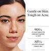 imageNeutrogena OilFree Acne Face Wash Fragrance Free Sensitive Skin Facial Cleanser with 2 Salicylic Acid Acne Treatment for Face 91 Fl Oz