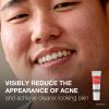 imageNeutrogena Rapid Clear Stubborn Acne Spot Treatment Gel with Maximum Strength 10 Benzoyl Peroxide Acne Treatment Medication Pimple Cream for Acne Prone Skin Care 1 oz 2 Pack