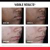imageNeutrogena Retinol SA Stubborn Marks PM Treatment FaceExfoliating Treatment to Help Reverse the Look of PostAcne Marks ampamp Uneven Skin Tone NonComedogenic PM Treatment unscented 10 Fl Oz