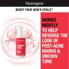 imageNeutrogena Retinol SA Stubborn Marks PM Treatment FaceExfoliating Treatment to Help Reverse the Look of PostAcne Marks ampamp Uneven Skin Tone NonComedogenic PM Treatment unscented 10 Fl Oz
