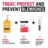imageNeutrogena Sensitive Skin Blemish Patches Acne Patches for Sensitive Skin Hydrocolloid Treatment Visibly Shrinks Pimples Overnight 2 Sizes 30 Count30 Count Pack of 1