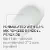 imageNeutrogena Stubborn Acne AM Face Treatment with 25 Micronized Benzoyl Peroxide Acne Medication OilFree Daily Facial Treatment Reduces Size ampamp Redness of Breakouts ParabenFree 20 oz
