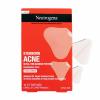 imageNeutrogena Sensitive Skin Blemish Patches Acne Patches for Sensitive Skin Hydrocolloid Treatment Visibly Shrinks Pimples Overnight 2 Sizes 30 Count10ct