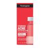 imageNeutrogena Stubborn Acne Spot Drying Lotion FragranceFree Sulfur Acne Treatment Clears Acne By Drying Up ampamp Shrinking Pimples Paraben ampamp OilFree 10 Sulfur ampamp 4 Niacinamide 10 fl oz